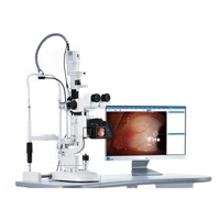 裂隙灯显微镜SM-800厂家销售价