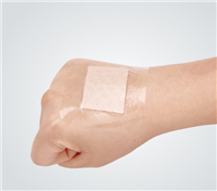 医用生物玻璃皮肤护理敷料零售价