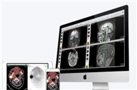 磁共振影像处理软件MItalytics.DWI厂家