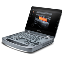 便携式彩色多普勒超声诊断仪MX3询价