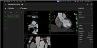 医学显微影像分析软件ZX-YX-D供应商