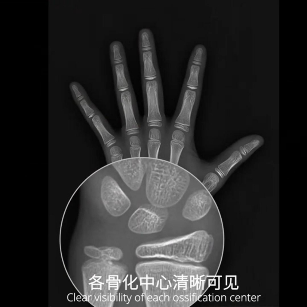 安智龄 AZK_Bone_Age 高效赋能读片 AI人工智能骨龄评测系统软件