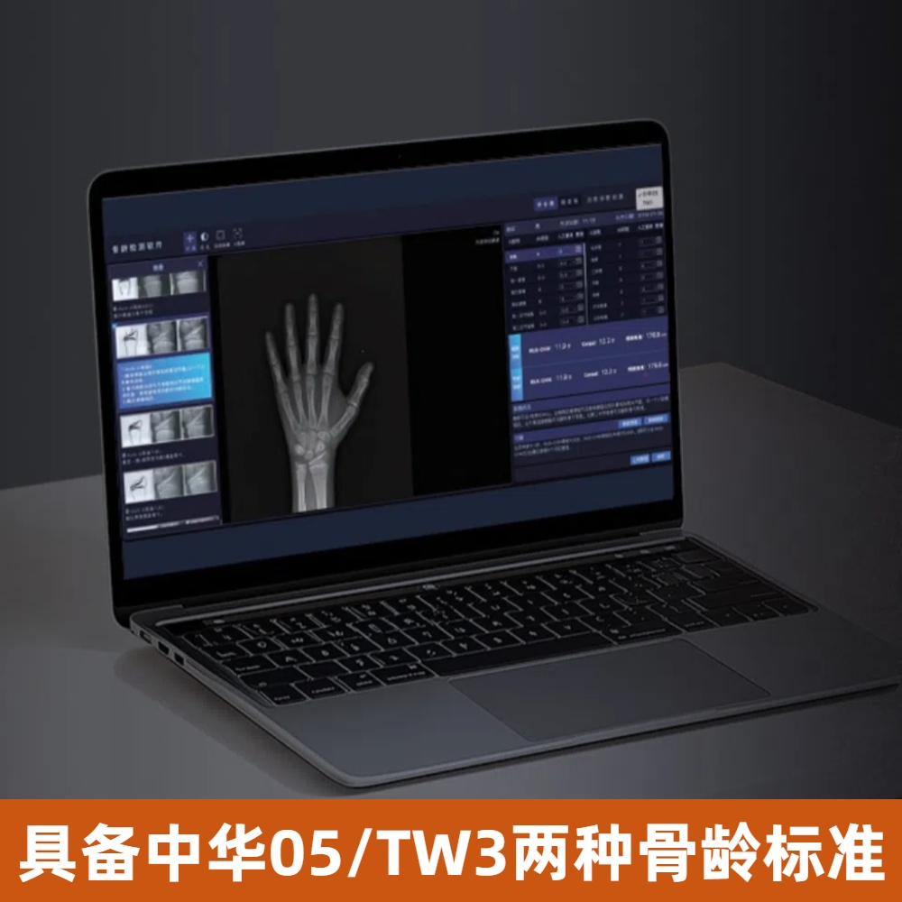 安智康生物 高效赋能读片 AI人工智能骨龄评测系统软件 AZK_Bone_Age