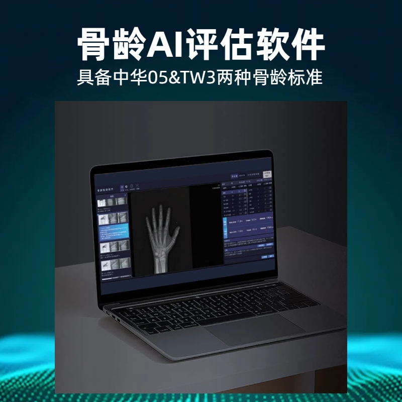 安智康生物 AZK_Bone_Age 三类医疗器械 AI人工智能骨龄评测系统软件