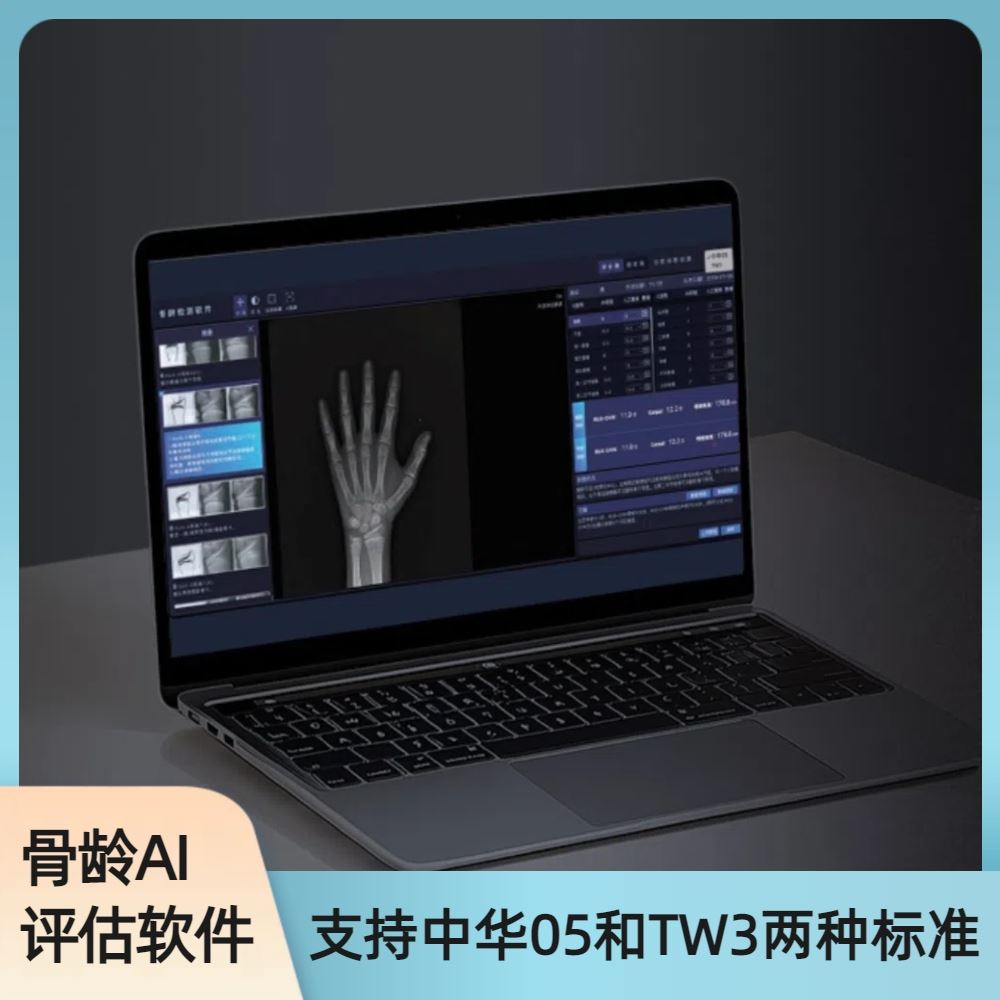 安智龄 误差仅0.28岁内 AZK_Bone_Age ai智能骨龄评测软件
