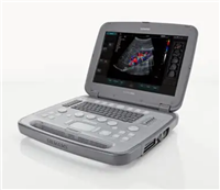 UDG3900B便携式超声诊断仪采购价