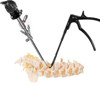 SPINAL-I脊柱内窥镜手术器械代理