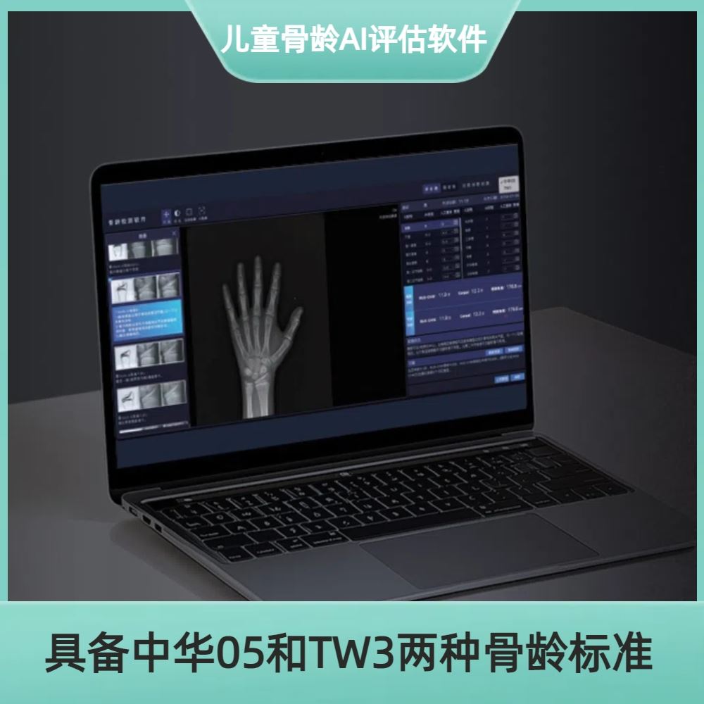安智龄 AZK_Bone_Age 三类医疗器械 骨龄测定年龄软件