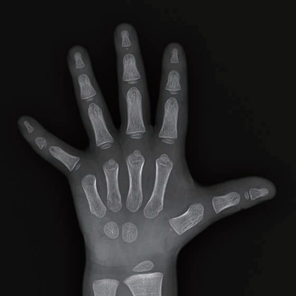 安智康 铅帘铅袖双层防护 身高管理机构 IDR-302HR-WF 骨龄分析仪器