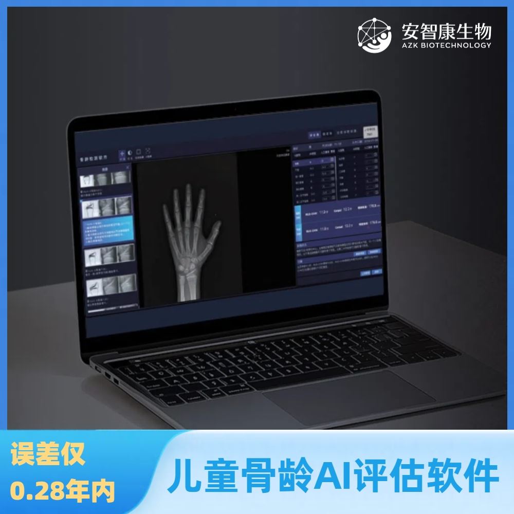安智康生物 误差仅0.28岁内 骨龄检测软件 AZK_Bone_Age