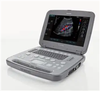 TINGSN FINDERS 1便携式彩色超声诊断仪厂家采购