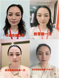 中医培训  浙江沐兰妙手骨雕培训班