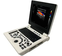 HY-V12掌上彩色多普勒超声诊断仪价格范围