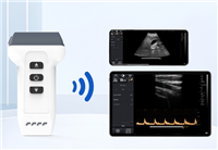 iSoniQ20无线掌上彩色多普勒超声诊断仪平台