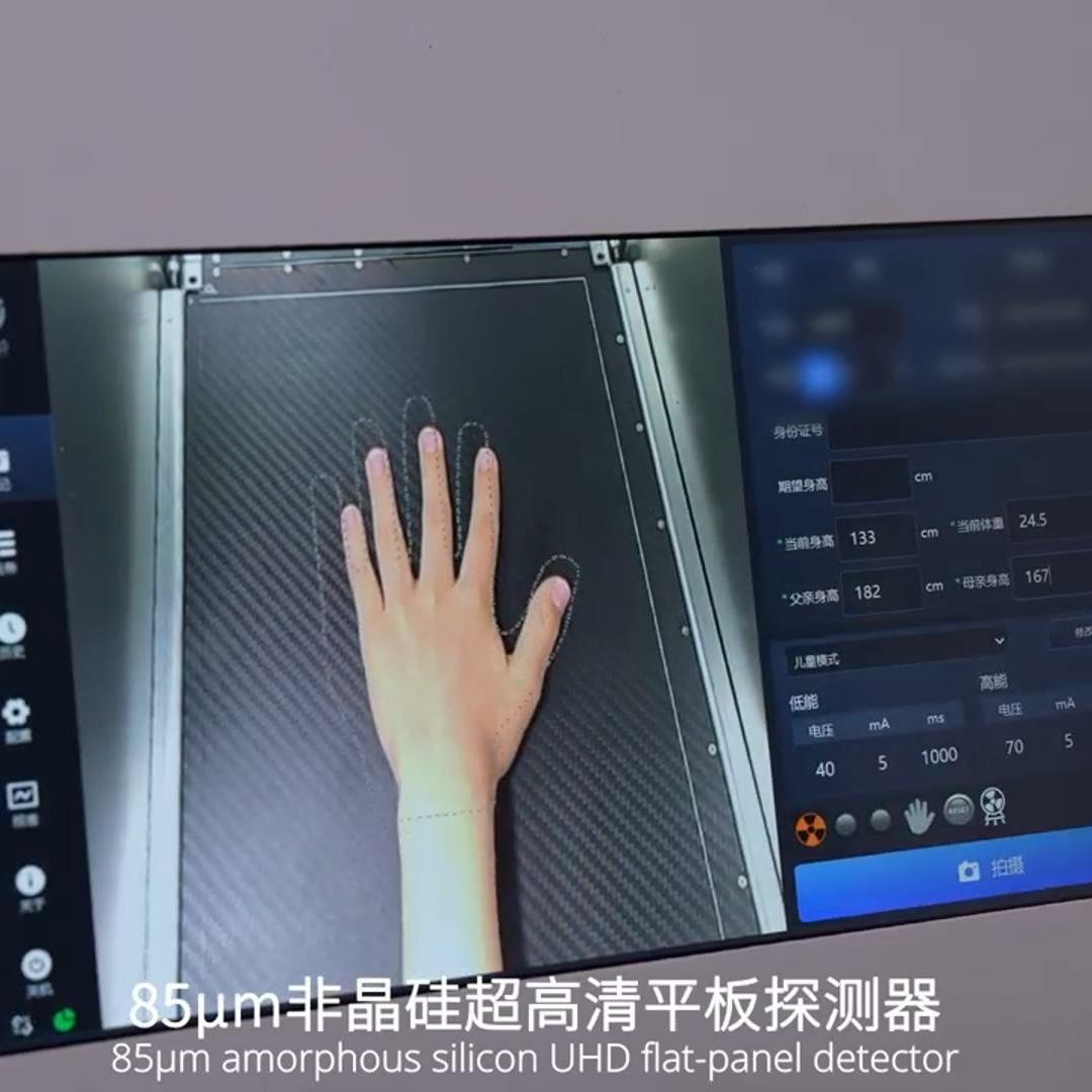 安智康 920万超高清像素 体检机构筛查 IDR-302HR-WF 骨龄检测设备