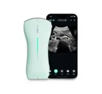 EF6-CLD 掌上无线彩色多普勒超声诊断仪采购价