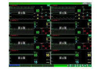 Buzzly-NSIS100中央监护管理软件厂家