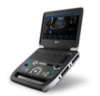 DU8-M2 全数字彩色多普勒超声诊断仪平台