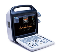 KU3全数字彩色多普勒超声诊断仪