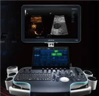 彩色多普勒超声诊断仪 Resona R9Q厂家
