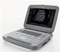 5500 便携式彩色多普勒超声诊断仪询价