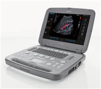 E2 便携式彩色多普勒超声诊断仪总代理