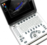 M11 便携式彩色多普勒超声诊断仪供应商联系方式