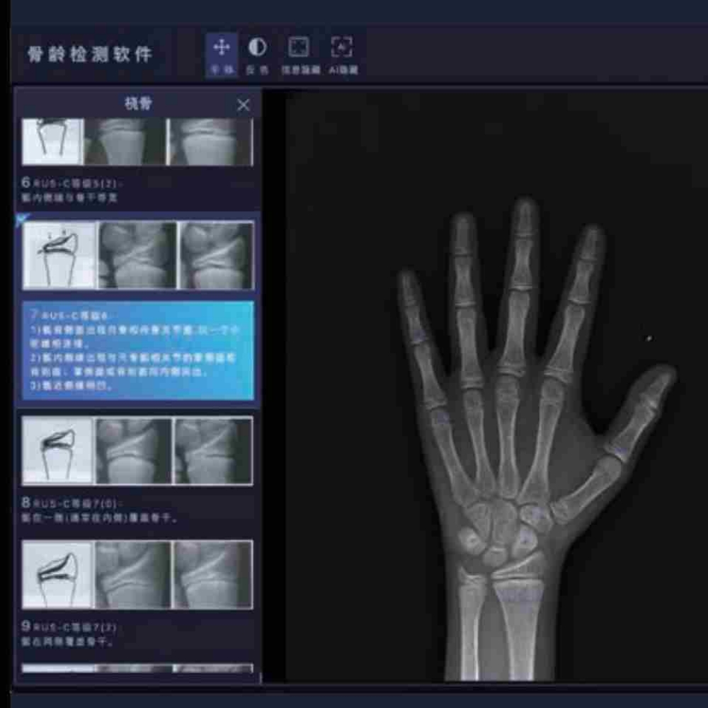 安智康 微剂量成像技术 体检机构筛查 IDR-302HR-WF 儿童骨龄分析仪器