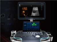 ResonaR9S 彩色多普勒超声诊断仪厂家销售价