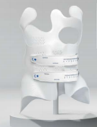3D打印脊柱侧弯侧弯定制支具