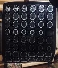 中山市印刷铝基版收购公司