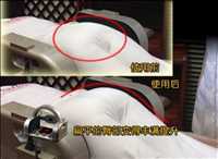 上海气压矫正盆骨修复仪操作视频矫正骨盆前倾